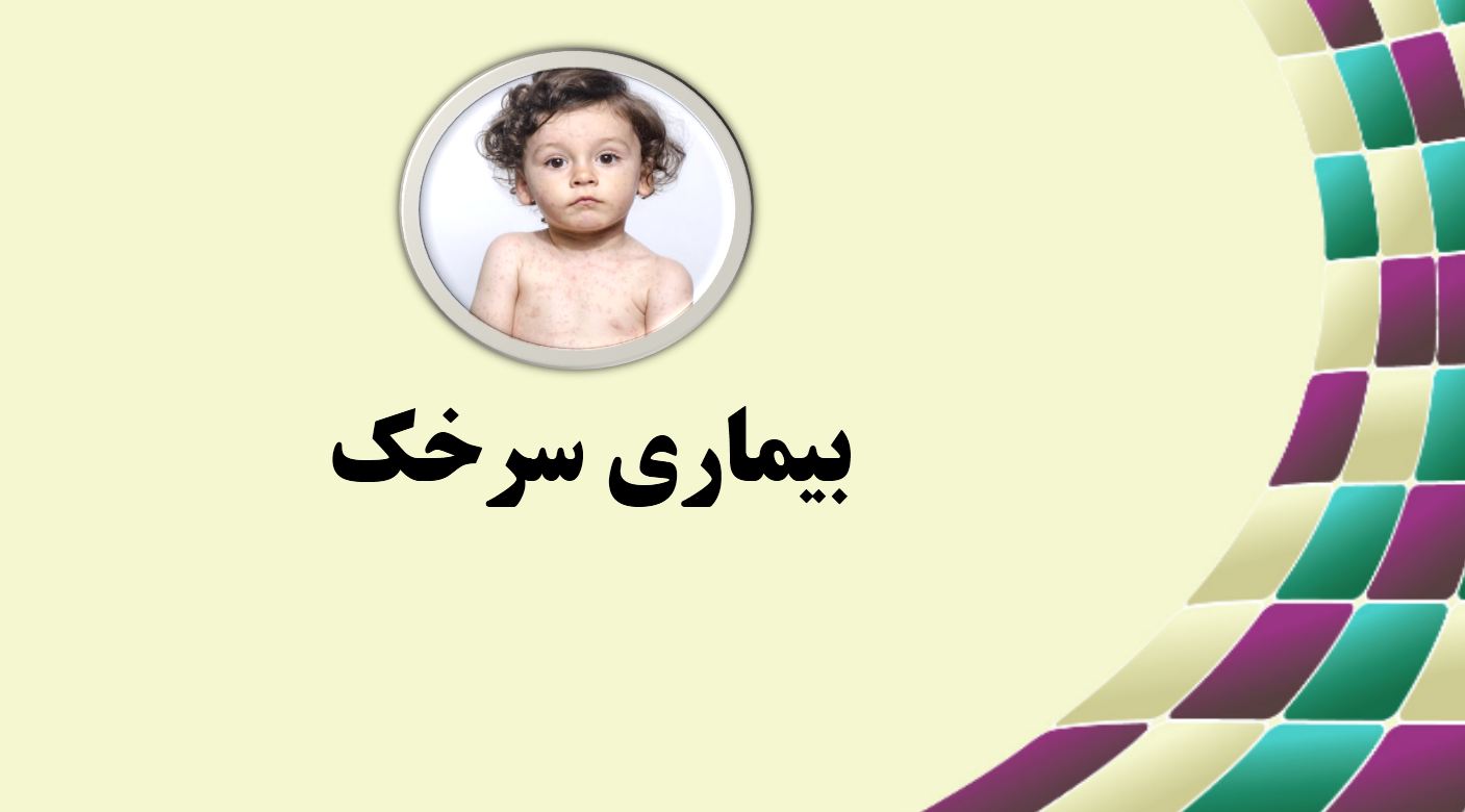پاورپوینت بیماری سرخک